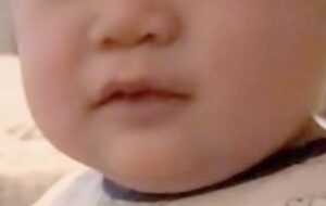 著者次男の乳児の頃の口元の写真
