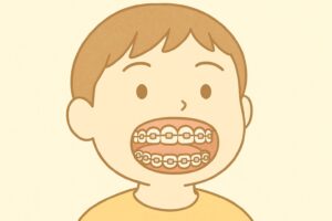 小学校低学年くらいの男の子が矯正装置をつけて笑っているイラスト