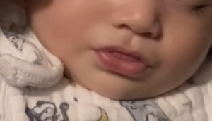 乳幼児期から寝ているときに、口を閉じないで舌を出し気味で寝ている写真