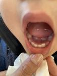 毎日の診療で小児の口の中を撮影して成長を確認しています。